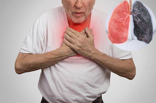 Triệu chứng COPD 