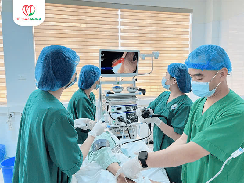 Hệ thống nội soi tiêu hóa