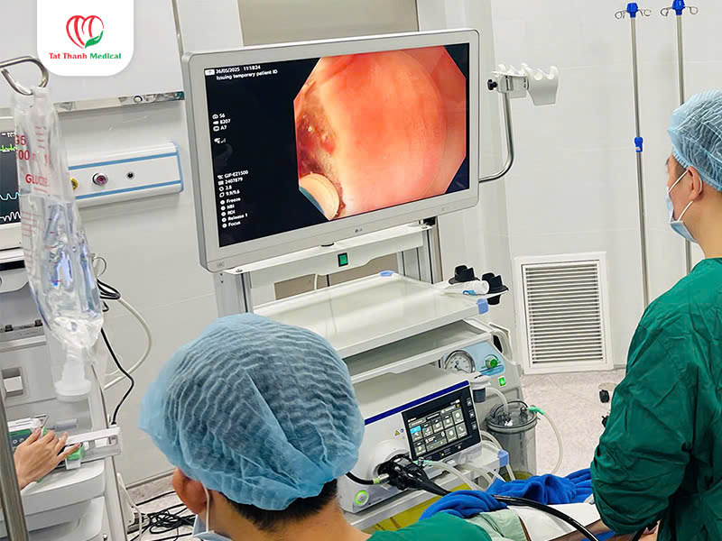 màn hình hệ thống nội soi tiêu hóa
