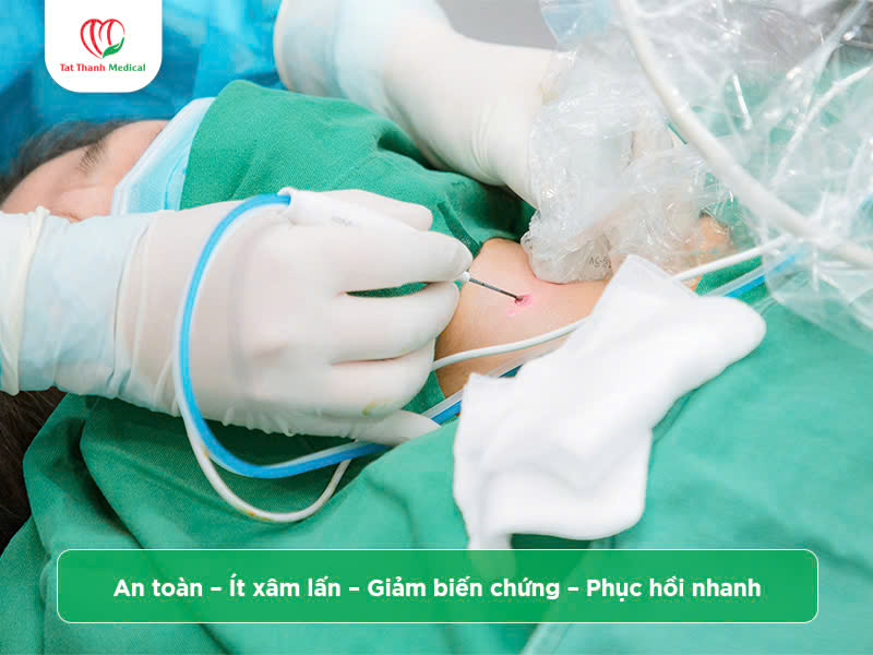 Máy đốt sóng cao tần u tuyến giáp: Lợi ích và địa chỉ mua hàng chính hãng