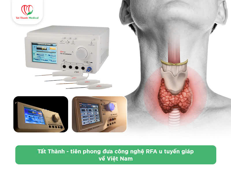 Máy đốt sóng cao tần u tuyến giáp: Lợi ích và địa chỉ mua hàng chính hãng