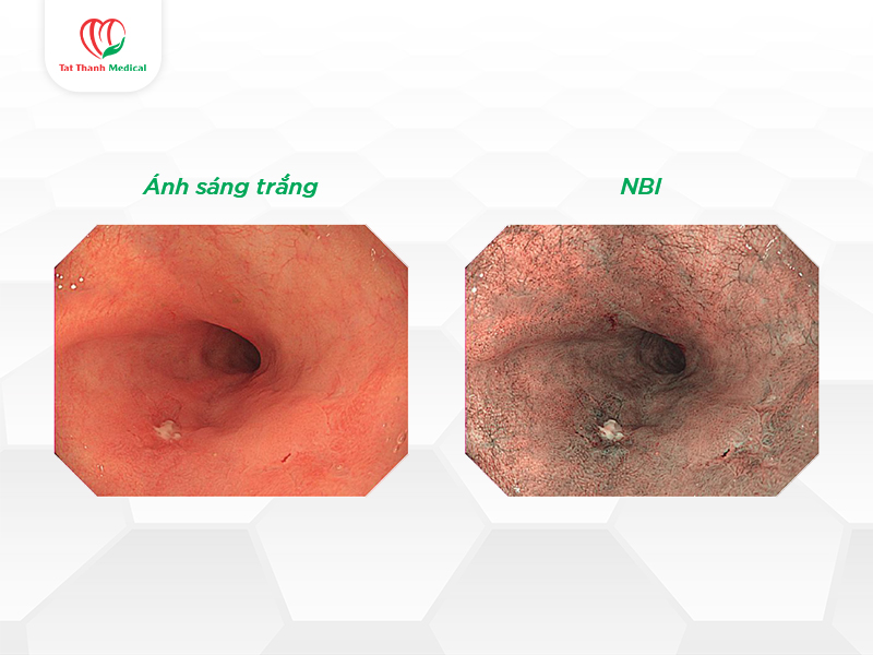Tối ưu quy trình nội soi: Công nghệ đang thay đổi vận hành phòng nội soi như thế nào?